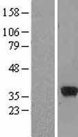 ARG1 / Arginase 1 Protein - Western validation with an anti-DDK antibody * L: Control HEK293 lysate R: Over-expression lysate