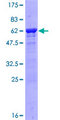 ARG1 / Arginase 1 Protein - 12.5% SDS-PAGE of human ARG1 stained with Coomassie Blue