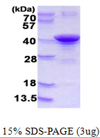 ARH / LDLRAP1 Protein