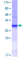 ARHGAP1 / CDC42GAP Protein - 12.5% SDS-PAGE Stained with Coomassie Blue.