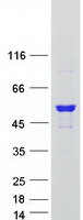 ARHGAP1 / CDC42GAP Protein - Purified recombinant protein ARHGAP1 was analyzed by SDS-PAGE gel and Coomassie Blue Staining