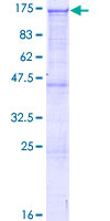 ARHGAP12 Protein - 12.5% SDS-PAGE of human ARHGAP12 stained with Coomassie Blue
