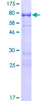 ARHGAP15 Protein - 12.5% SDS-PAGE of human ARHGAP15 stained with Coomassie Blue