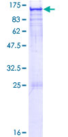 ARHGAP17 / NADRIN Protein - 12.5% SDS-PAGE of human ARHGAP17 stained with Coomassie Blue