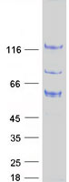 ARHGAP17 / NADRIN Protein - Purified recombinant protein ARHGAP17 was analyzed by SDS-PAGE gel and Coomassie Blue Staining
