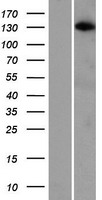 ARHGAP20 Protein - Western validation with an anti-DDK antibody * L: Control HEK293 lysate R: Over-expression lysate