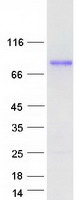 ARHGAP22 / RhoGAP2 Protein - Purified recombinant protein ARHGAP22 was analyzed by SDS-PAGE gel and Coomassie Blue Staining