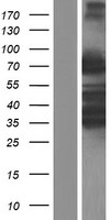 ARHGAP25 Protein - Western validation with an anti-DDK antibody * L: Control HEK293 lysate R: Over-expression lysate