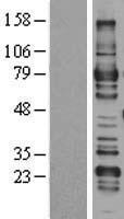 ARHGAP25 Protein - Western validation with an anti-DDK antibody * L: Control HEK293 lysate R: Over-expression lysate
