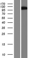 ARHGAP26 / GRAF Protein - Western validation with an anti-DDK antibody * L: Control HEK293 lysate R: Over-expression lysate