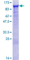 ARHGAP26 / GRAF Protein - 12.5% SDS-PAGE of human ARHGAP26 stained with Coomassie Blue