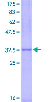 ARHGAP26 / GRAF Protein - 12.5% SDS-PAGE Stained with Coomassie Blue.