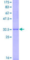 ARHGAP26 / GRAF Protein - 12.5% SDS-PAGE Stained with Coomassie Blue.