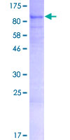 ARHGAP28 Protein - 12.5% SDS-PAGE of human ARHGAP28 stained with Coomassie Blue
