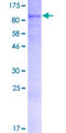 ARHGAP28 Protein - 12.5% SDS-PAGE of human ARHGAP28 stained with Coomassie Blue