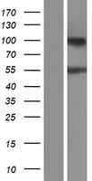 ARHGAP30 Protein - Western validation with an anti-DDK antibody * L: Control HEK293 lysate R: Over-expression lysate