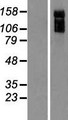 ARHGAP31 / CDGAP Protein - Western validation with an anti-DDK antibody * L: Control HEK293 lysate R: Over-expression lysate