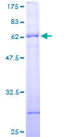 ARHGAP32 / RICS / p250GAP Protein - 12.5% SDS-PAGE of human RICS stained with Coomassie Blue