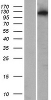 ARHGAP33 / SNX26 Protein - Western validation with an anti-DDK antibody * L: Control HEK293 lysate R: Over-expression lysate