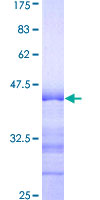 ARHGAP4 Protein - 12.5% SDS-PAGE Stained with Coomassie Blue.