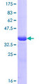 ARHGAP45 Protein - 12.5% SDS-PAGE Stained with Coomassie Blue.
