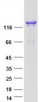 ARHGAP45 Protein - Purified recombinant protein ARHGAP45 was analyzed by SDS-PAGE gel and Coomassie Blue Staining