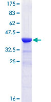 ARHGAP6 Protein - 12.5% SDS-PAGE Stained with Coomassie Blue.