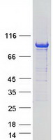 ARHGAP6 Protein - Purified recombinant protein ARHGAP6 was analyzed by SDS-PAGE gel and Coomassie Blue Staining
