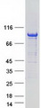 ARHGAP6 Protein - Purified recombinant protein ARHGAP6 was analyzed by SDS-PAGE gel and Coomassie Blue Staining