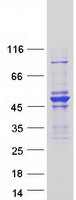 ARHGAP8 Protein - Purified recombinant protein ARHGAP8 was analyzed by SDS-PAGE gel and Coomassie Blue Staining