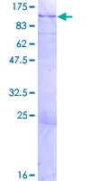 ARHGAP9 Protein - 12.5% SDS-PAGE of human ARHGAP9 stained with Coomassie Blue