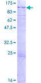 ARHGAP9 Protein - 12.5% SDS-PAGE of human ARHGAP9 stained with Coomassie Blue