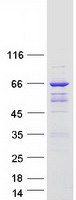 ARHGAP9 Protein - Purified recombinant protein ARHGAP9 was analyzed by SDS-PAGE gel and Coomassie Blue Staining