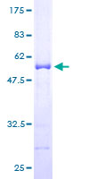 ARHGDIA / RHOGDI Protein - 12.5% SDS-PAGE of human ARHGDIA stained with Coomassie Blue
