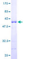 ARHGDIA / RHOGDI Protein - 12.5% SDS-PAGE of human ARHGDIA stained with Coomassie Blue