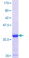 ARHGDIA / RHOGDI Protein - 12.5% SDS-PAGE Stained with Coomassie Blue.
