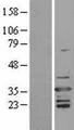 ARHGDIB / D4 GDI Protein - Western validation with an anti-DDK antibody * L: Control HEK293 lysate R: Over-expression lysate