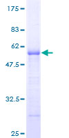 ARHGDIG / RHOGDI-3 Protein - 12.5% SDS-PAGE of human ARHGDIG stained with Coomassie Blue