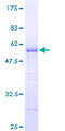 ARHGDIG / RHOGDI-3 Protein - 12.5% SDS-PAGE of human ARHGDIG stained with Coomassie Blue
