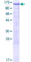 ARHGEF1 Protein - 12.5% SDS-PAGE of human ARHGEF1 stained with Coomassie Blue