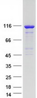ARHGEF1 Protein - Purified recombinant protein ARHGEF1 was analyzed by SDS-PAGE gel and Coomassie Blue Staining