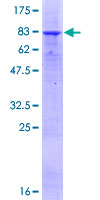 ARHGEF10 / GEF10 Protein - 12.5% SDS-PAGE of human ARHGEF10 stained with Coomassie Blue