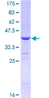 ARHGEF10 / GEF10 Protein - 12.5% SDS-PAGE Stained with Coomassie Blue.