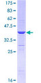 ARHGEF10 / GEF10 Protein - 12.5% SDS-PAGE Stained with Coomassie Blue.