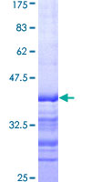 ARHGEF11 Protein - 12.5% SDS-PAGE Stained with Coomassie Blue.