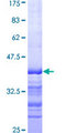 ARHGEF11 Protein - 12.5% SDS-PAGE Stained with Coomassie Blue.