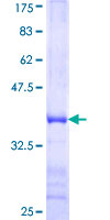 ARHGEF12 Protein - 12.5% SDS-PAGE Stained with Coomassie Blue.