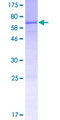 ARHGEF16 Protein - 12.5% SDS-PAGE of human ARHGEF16 stained with Coomassie Blue