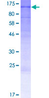 ARHGEF19 / WGEF Protein - 12.5% SDS-PAGE of human ARHGEF19 stained with Coomassie Blue