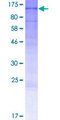 ARHGEF19 / WGEF Protein - 12.5% SDS-PAGE of human ARHGEF19 stained with Coomassie Blue